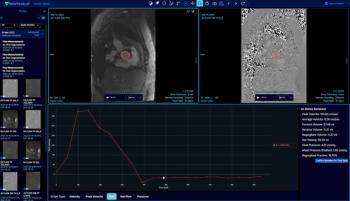 FDA Clears AI Software for Automated Measurements on Cardiac MRI