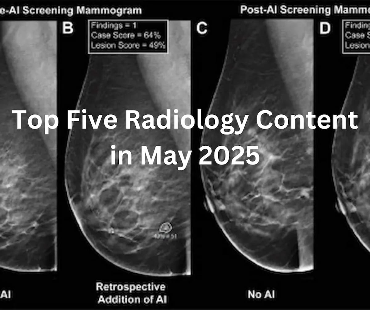 Top Five Radiology Content in May 2025