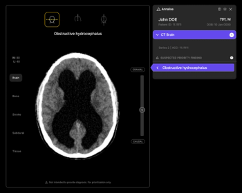 Annalise ai Introduces Radiology Triage Suite for Head CT and Chest X-Ray Exams