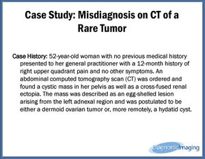 Misdiagnosis on CT of a Rare Tumor