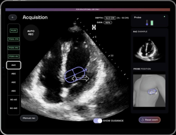 FDA Clears Emerging AI-Enabled Software for Cardiac Ultrasound