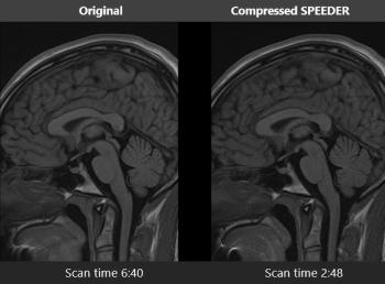Canon SPEEDER software
