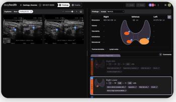 ECR Study: Adjunctive AI Facilitates 38 Percent Reduction in Ultrasound Assessment Time for Thyroid Nodules