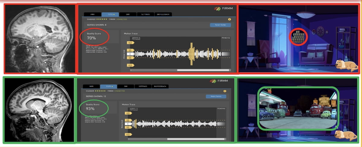 Could Gamification Enhance Brain MRI Acquisition?
