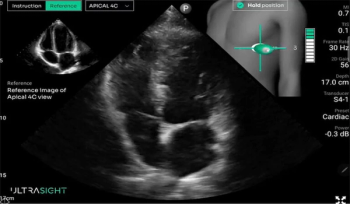 What New Research Reveals About Novice Use of AI-Guided Cardiac Ultrasound
