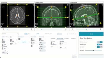 ScanLab Unveils New Signal-to-Noise Ratio (SNR) Calculator for MRI