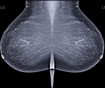 Biennial Mammography Over Annual Mammography?: USPSTF Issues Updated Breast Cancer Screening Recommendations