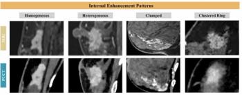 Can Photon-Counting CT Have an Impact in Breast Cancer Staging?