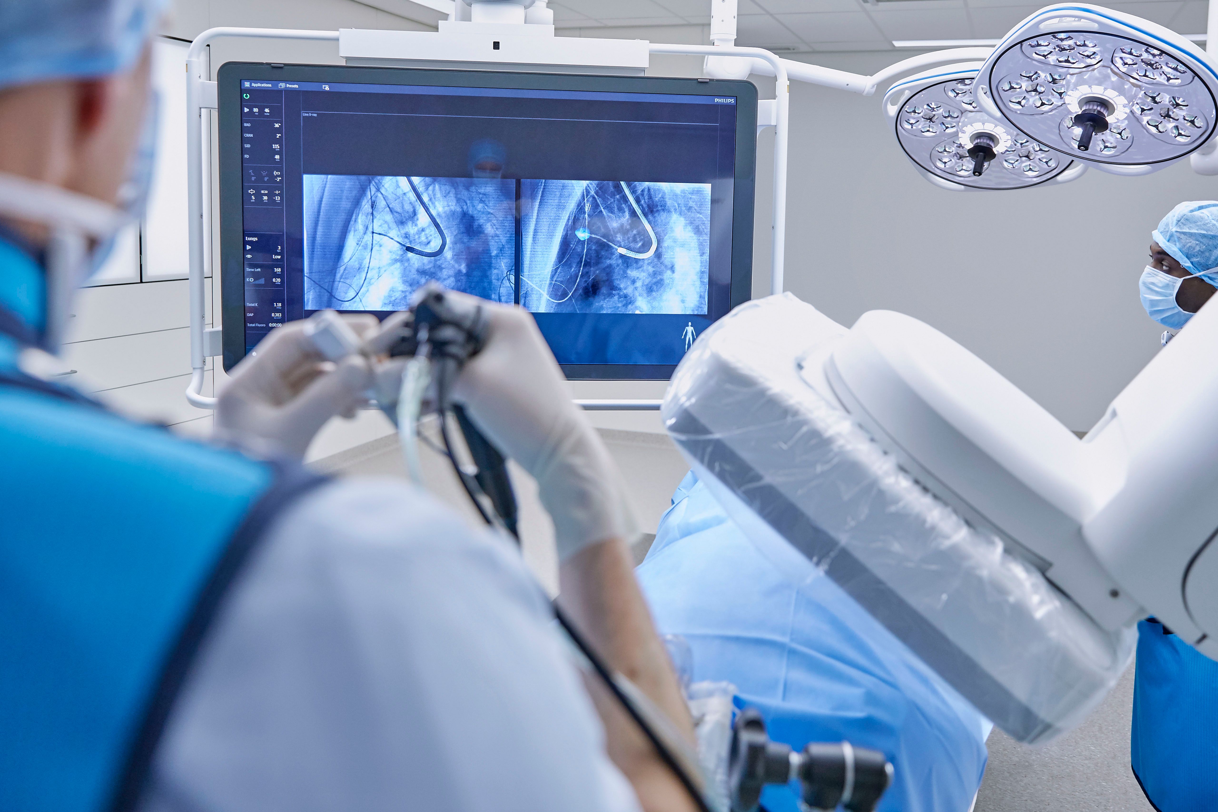 Philips Launches 3D CT/X-Ray System For Faster Lung Cancer Diagnosis