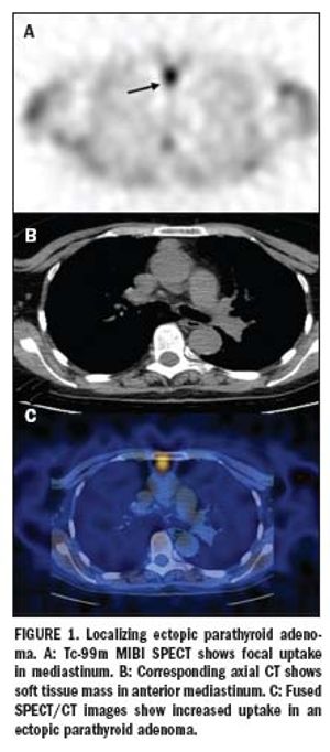 Multislice SPECT/CT gains wider clinical acceptance