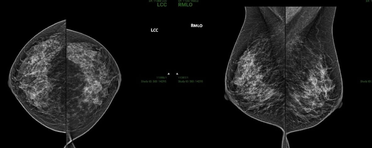 Could Cloud-Based ‘Progressive Loading’ be a Boon for Radiology Workflows?