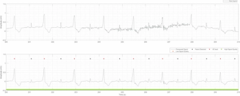FDA Clears New Electrocardiogram Suite of Algorithms and Analytics
