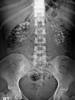 Image IQ Quiz: Patient Presents with Hyperparathyroidism