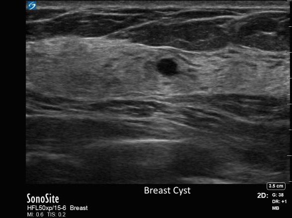 The Evolution of Point-of-Care Ultrasound