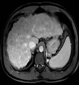 Image IQ: 67-year-old Male, Worsening Fatigue, Jaundice
