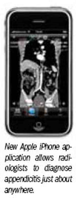 iPhone enables fast diagnosis of appendicitis