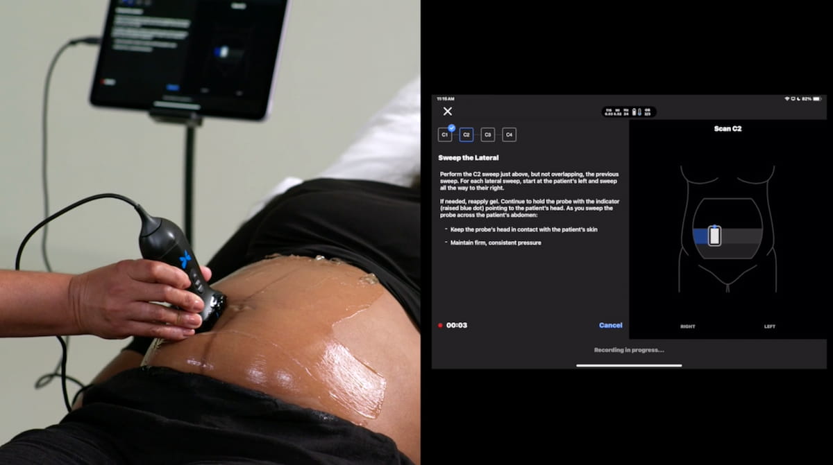 FDA Clears AI-Powered Ultrasound Tool That Determines Gestational Age in Minutes