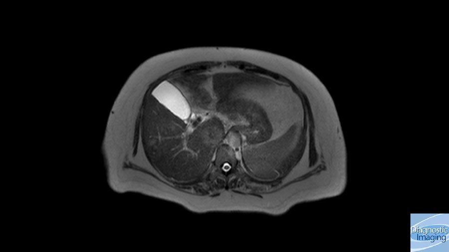 Bilateral Lower Limb Swelling Diagnostic Imaging