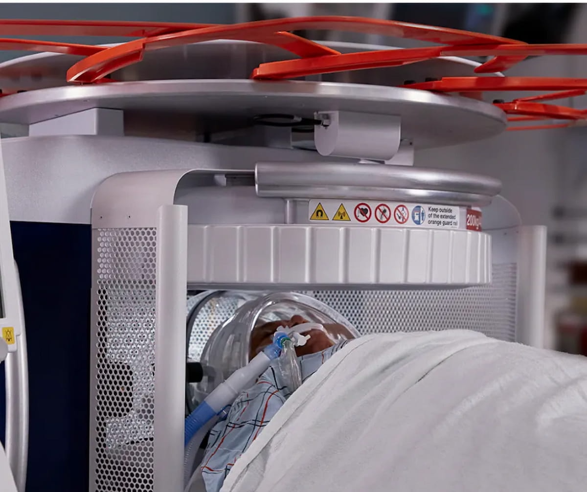 FDA Clears AI-Enabled Denoising Feature for DWI Sequences on Portable Brain MRI System