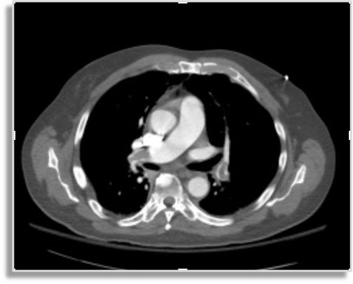 Image IQ Quiz: Middle-Aged Male with Chest Pain and Shortness of Breath
