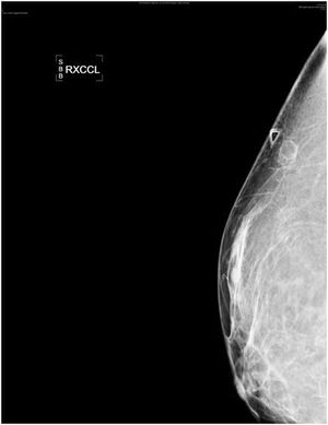 Two Oil Cysts
