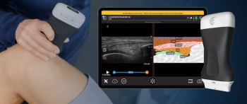 Clarius Mobile Health Unveils Anterior Knee Feature for Handheld Ultrasound