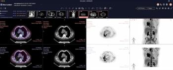 New Lantern Unveils AI-Powered PET/CT and Mammography Viewers