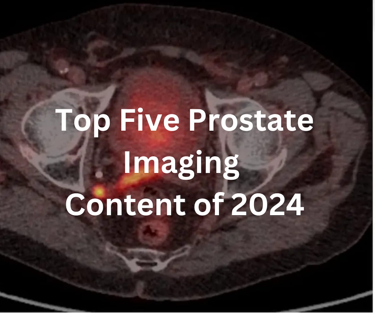 Diagnostic Imaging's Top Five Prostate Imaging Content of 2024