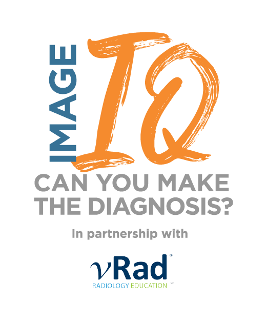 Image IQ Quiz: Young Adult Female with Fever and Circulatory Collapse
