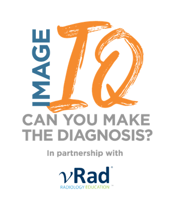 Image IQ Quiz: 28-Year-Old Male with Visual Impairment