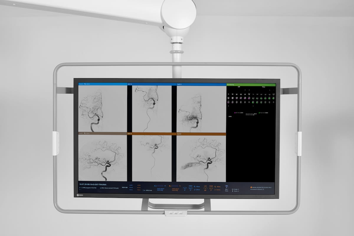 Fda Clears Ai-powered Quantitative Perfusion Mapping For Cone-beam Ct