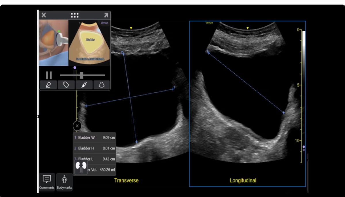 GE HealthCare Unveils Enhancements to Venue Point-of-Care Ultrasound Systems