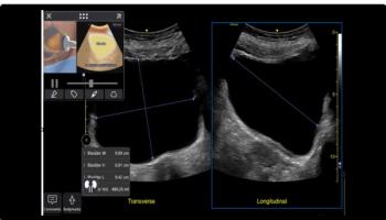 GE HealthCare Unveils Enhancements to Venue Point-of-Care Ultrasound Systems