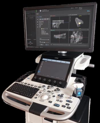 FDA Clears Emerging 3D Ultrasound Technology