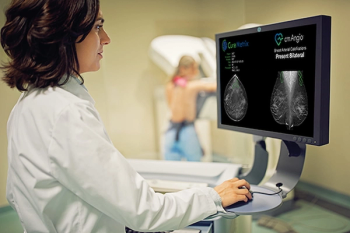 FDA Expands Clearance for AI Mammography Software for Breast Arterial Calcification Detection