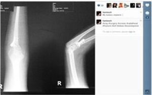 Social Image-sharing Apps Exposing Patient Information