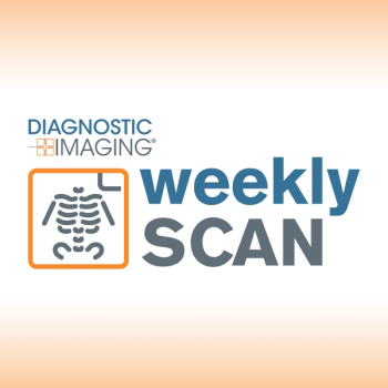 Diagnostic Imaging's Weekly Scan: May 25 — May 31