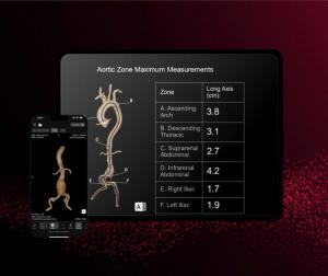 FDA Clears CT-Based AI for Aortic Assessment and Monitoring 
