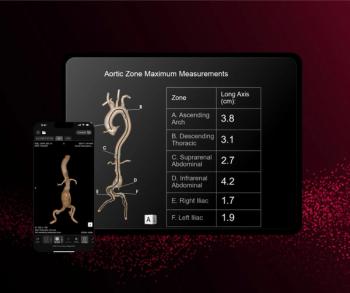 FDA Clears CT-Based AI for Aortic Assessment and Monitoring 