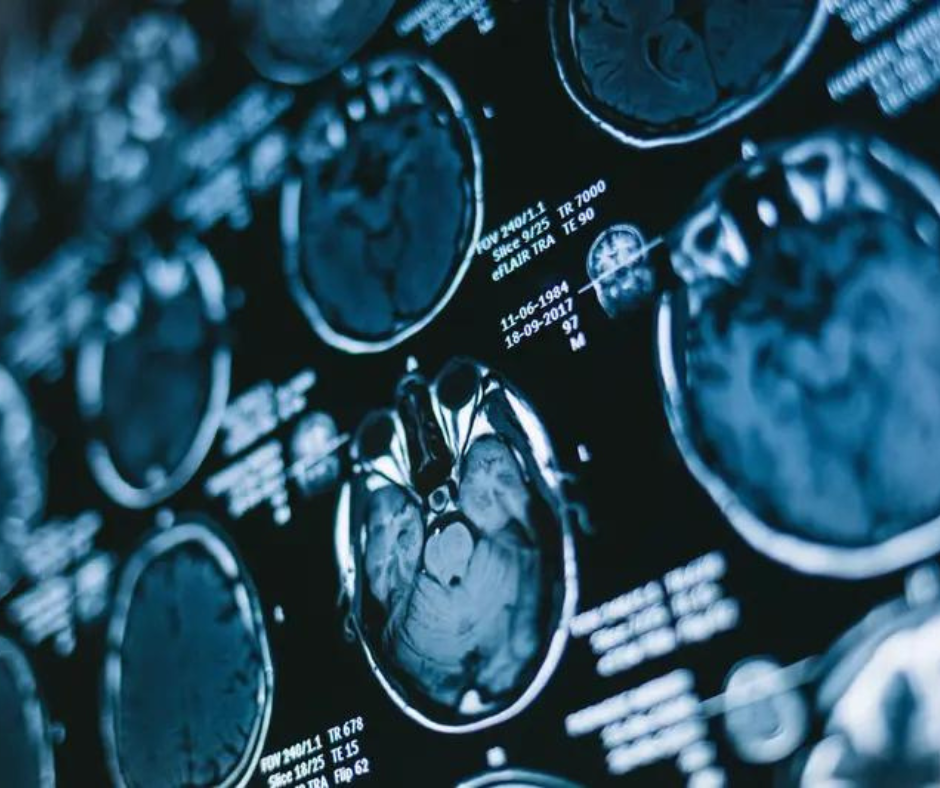 Emerging Deep Learning System May Enhance MRI Assessment of Intracranial Tumors
