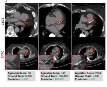 Can AI Assessment of CT Attenuation Correction Mapping Be a Viable Alternative for CAC Risk Stratification?