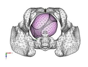 Imaging Software Simulates Childbirth