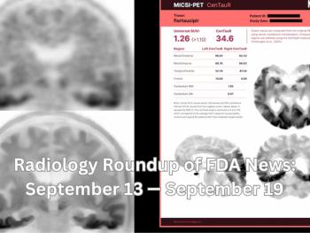 Radiology Roundup of FDA News: September 13 — September 19