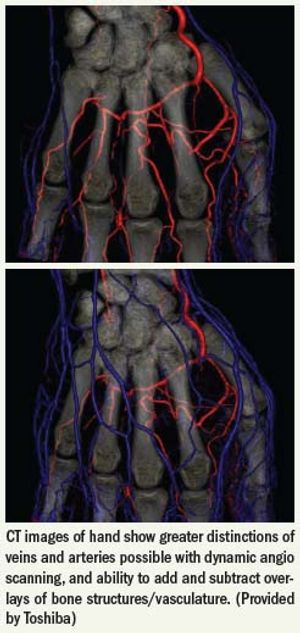 Dynamic volume propels CT into fourth dimension
