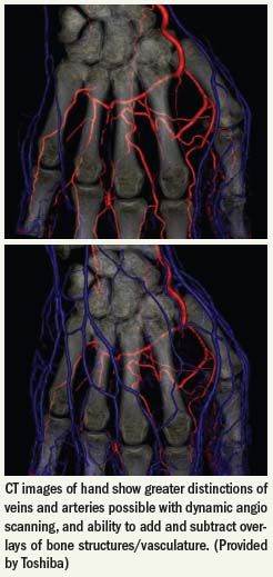 Dynamic volume propels CT into fourth dimension