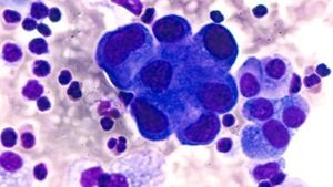 Virtual Biopsy: A Safer Future for Cancer Management 