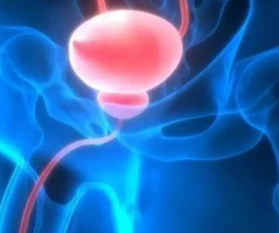 New Study Shows Benefits of Prostate Artery Embolization for Men with an Enlarged Prostate