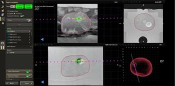 FDA Clears Updated MRI/Ultrasound Fusion System for Use in Focal Therapy of Prostate Cancer