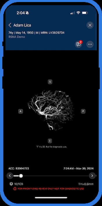 Viz.ai Unveils AI-Powered Software for 3D CTA Neurovascular Imaging