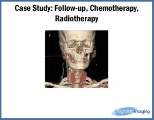 Follow-up, Chemotherapy, Radiotherapy